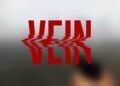 Vein update 0019